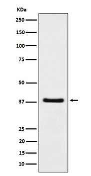 HDGF Rabbit Monoclonal Antibody