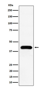 MVD Rabbit Monoclonal Antibody
