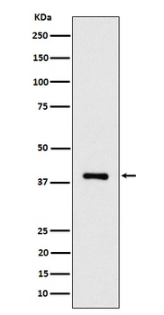 ACAT2 Rabbit Monoclonal Antibody