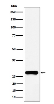 GSTO1 Rabbit Monoclonal Antibody