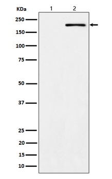 Phospho-ErbB2 Rabbit Monoclonal Antibody