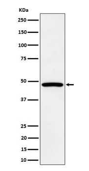 PTPN2 Rabbit Monoclonal Antibody