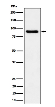 C1s Rabbit Monoclonal Antibody