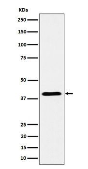 ADH4 Rabbit Monoclonal Antibody