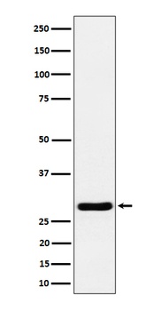Calcipressin 1 Rabbit Monoclonal Antibody