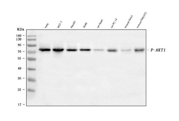Phospho-TAK1/TAK1 Rabbit Monoclonal Antibody