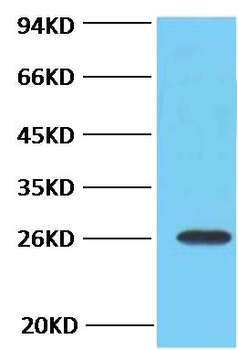 Bcl-2 Mouse mAb Antibody
