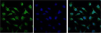 Bcl-2 Mouse mAb Antibody