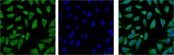 HSP70 Mouse mAb Antibody