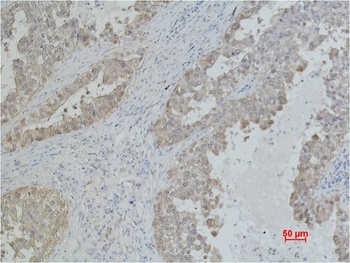 HSP70 Mouse mAb Antibody