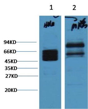 CK8 Mouse mAb Antibody
