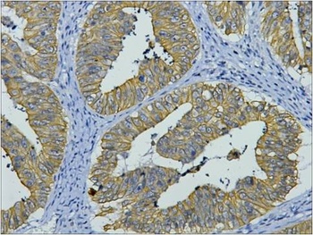 CK8 Mouse mAb Antibody