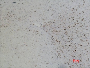 GFAP Mouse mAb Antibody
