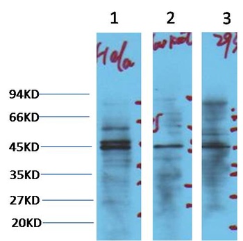 NSE Mouse mAb Antibody