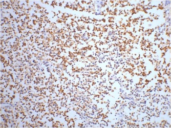 NSE Mouse mAb Antibody