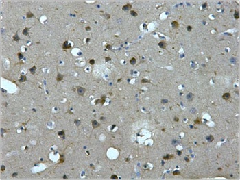 MAP2 Mouse mAb Antibody