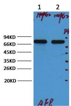 AFP/alpha 1 Fetoprotein Mouse mAb Antibody