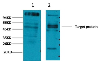 CD23 Mouse mAb Antibody