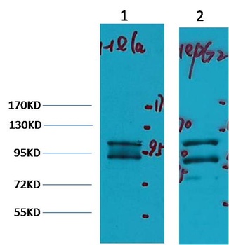 IDE/Insulin Degrading Enzyme Mouse mAb Antibody