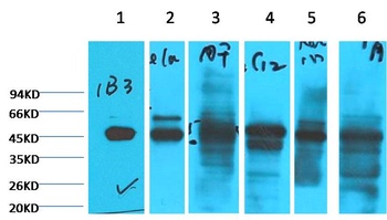 Cytokeratin 18 Mouse mAb Antibody