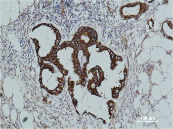 Cytokeratin 18 Mouse mAb Antibody