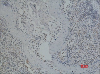 CD41/Integrin α/2b Mouse mAb Antibody
