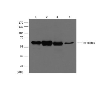 NFkB p65 Mouse mAb Antibody