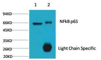 NFkB p65 Mouse mAb Antibody