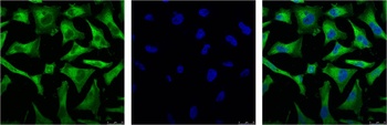 NFkB p65 Mouse mAb Antibody