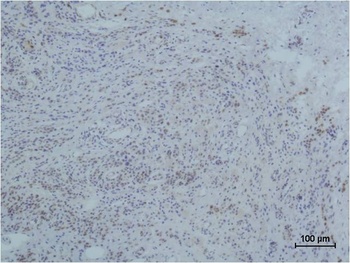 Collagen III Mouse mAb Antibody