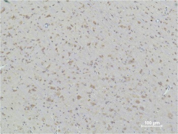 HSP90β Mouse mAb Antibody