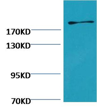 Fibronectin Mouse mAb Antibody