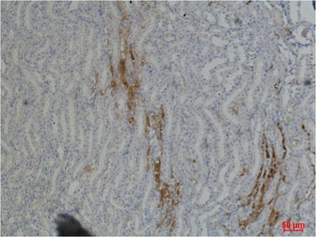 Fibronectin Mouse mAb Antibody