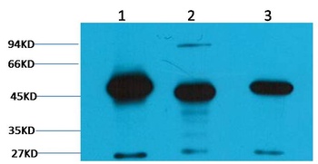 FH/Fumarase Mouse mAb Antibody
