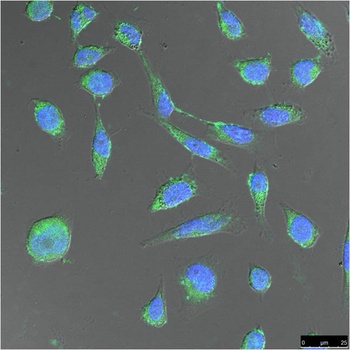 FH/Fumarase Mouse mAb Antibody