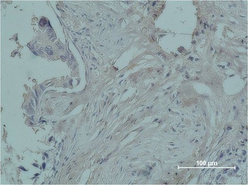 Progesterone Receptor Mouse mAb Antibody