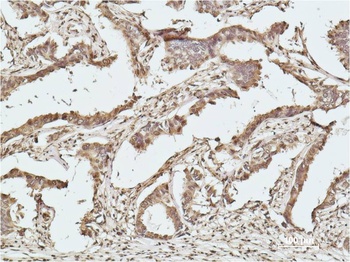 Histone H2B Mouse mAb Antibody