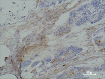 β III tubulin Mouse mAb Antibody