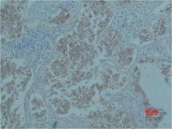 β-Catenin Mouse mAb Antibody