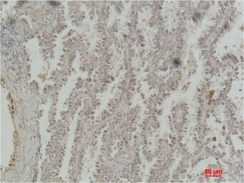 CREB Mouse mAb Antibody