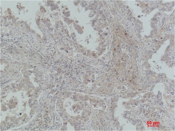 CBARA1/MICU1 Mouse mAb Antibody
