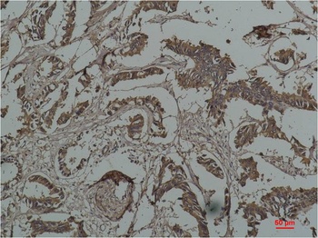HSP27 Mouse mAb Antibody