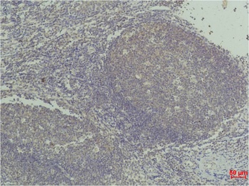 TNF α Mouse mAb Antibody