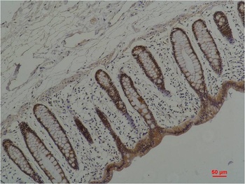 HSP90 α Mouse mAb Antibody
