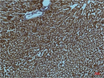 PI3 Kinase P85α Mouse mAb Antibody