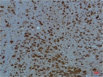 PI3 Kinase P85α Mouse mAb Antibody