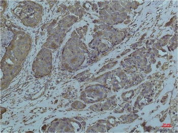 GRP78/Bip Mouse mAb Antibody