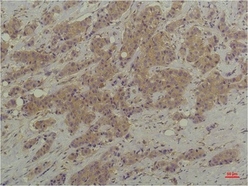 P44/42 MAPK(ERK1/2) Mouse mAb