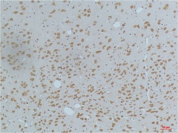 CaMKIIβ/γ/δ (Phospho Thr287) Mouse mAb Antibody