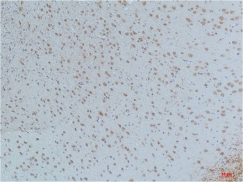 CaMKIIβ/γ/δ (Phospho Thr287) Mouse mAb Antibody